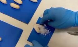 MİDESİNDE ÖLÜM TAŞIDI