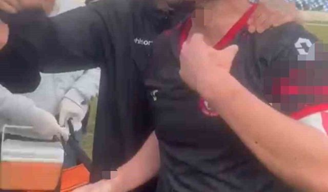 AMATÖR LİG’DE KAVGA: YÜZÜ KANLAR İÇİNDE KALDI