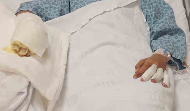 ISINMAK İSTERKEN KENDİNİ YAKTI!