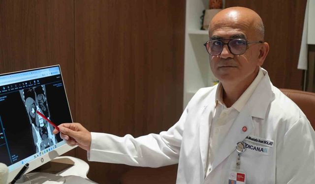 25 cm küplük böbrek taşı, hastanın sırtından girilerek çıkartıldı