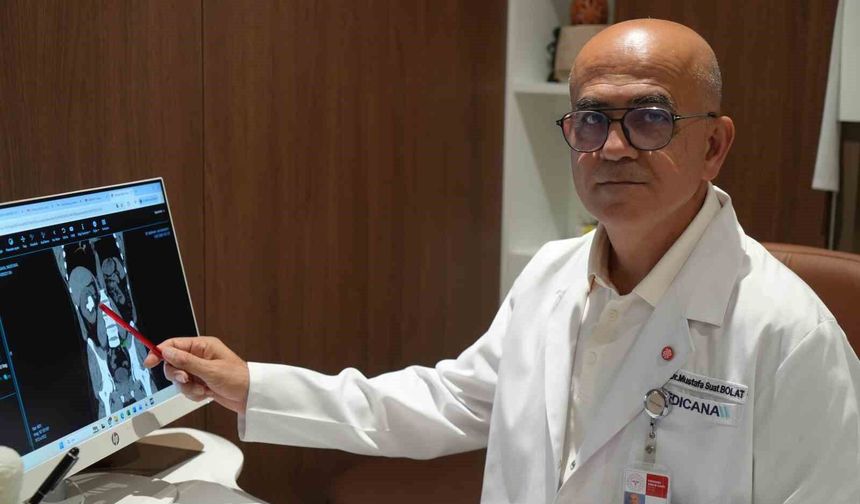 25 cm küplük böbrek taşı, hastanın sırtından girilerek çıkartıldı